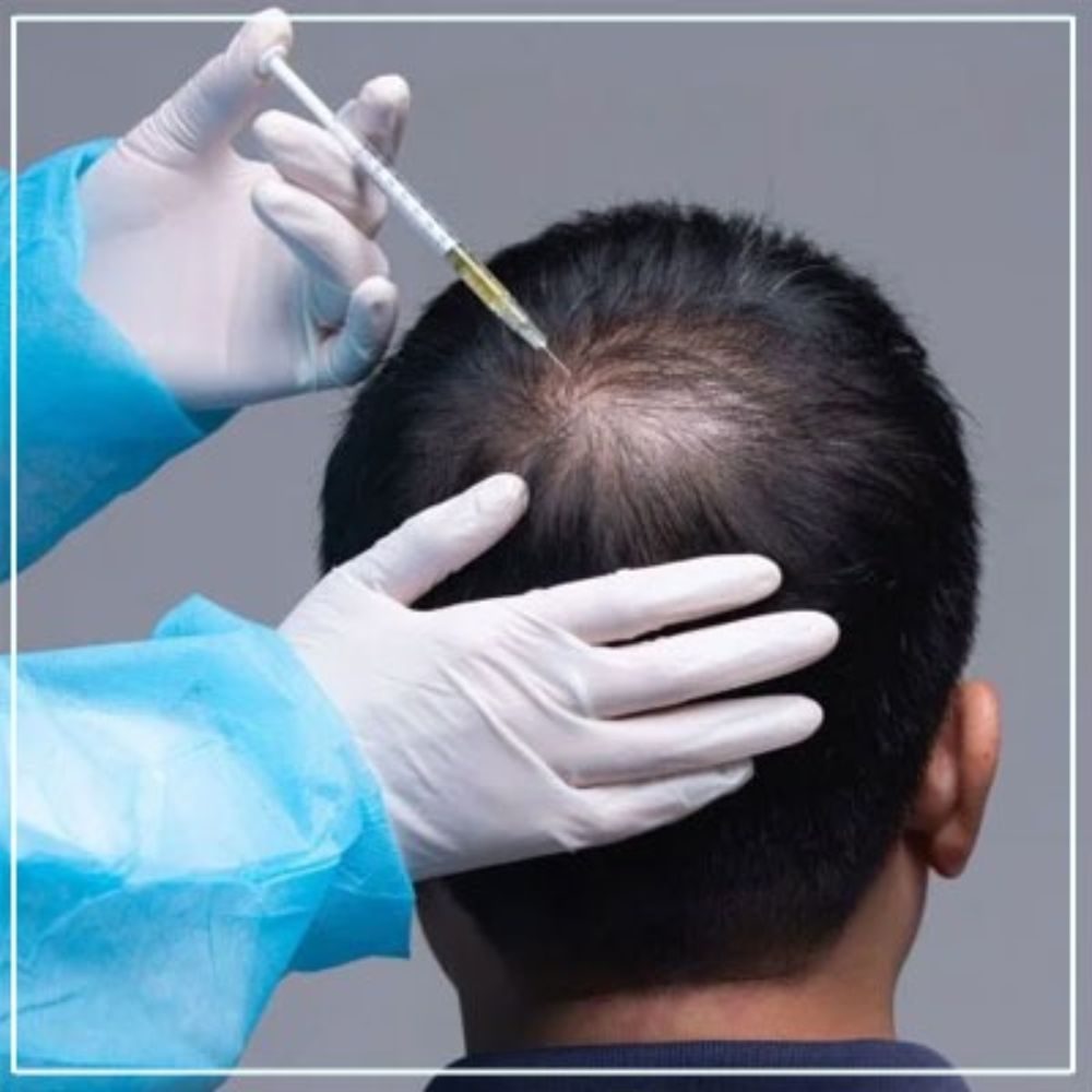 GFC (Growth Factor Concentrate)